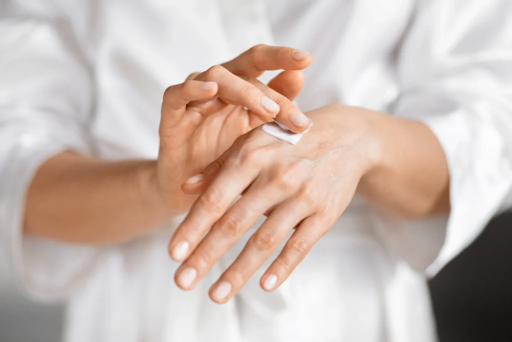 Hands applying a topical cream, representing compounded dermatology treatments